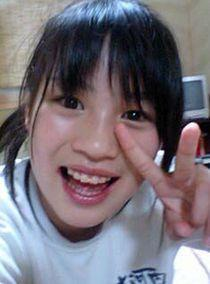 のん（能年玲奈）